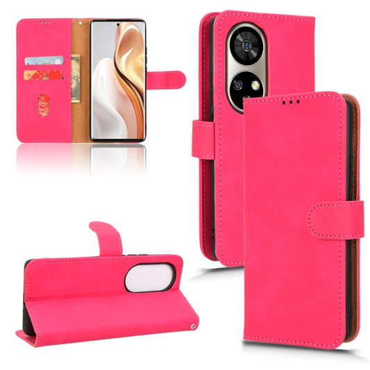 For Ulefone Note 17 Pro Skin Feel Magnetic Flip Leather Phone Case(Rose Red) - Ulefone Cases by buy2fix | Online Shopping UK | buy2fix