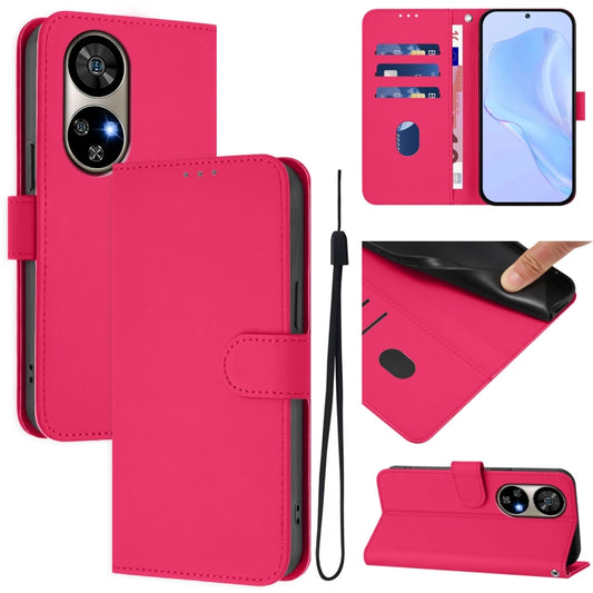 For Ulefone Note 17 Pro Skin Feel Solid Color Leather Phone Case with Lanyard(Rose Red) - Ulefone Cases by buy2fix | Online Shopping UK | buy2fix